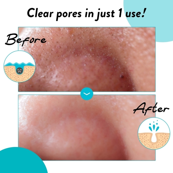 Soo'AE Black Charcoal Peel Off Mask, Pore Care + Clarifying, Made In Korea, NEW - Picture 7 of 9